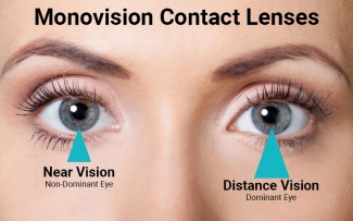 Monovision Contact Lenses